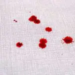 How to Get blood out of a carpet