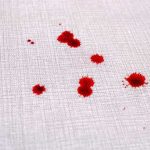 How to Get blood out of carpet